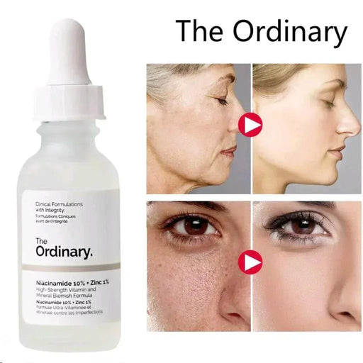 The Ordinary Niacinamide Serum & The Ordinary Facewash.